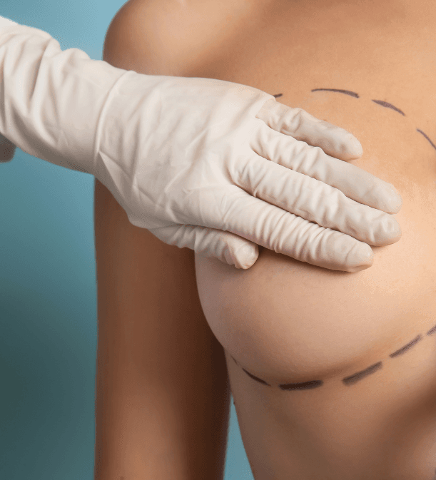 BREAST
